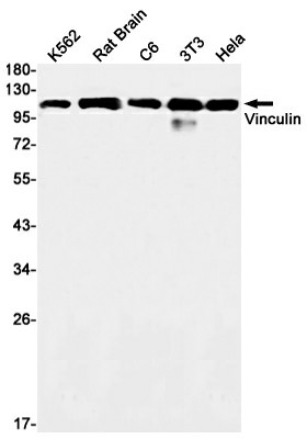 Recombinant Vinculin Monoclonal Antibody (E-AB-81494)