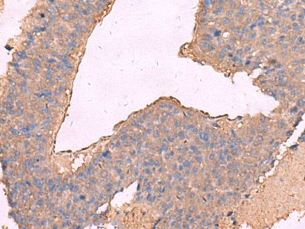 KCNN2 Polyclonal Antibody (E-AB-18171)