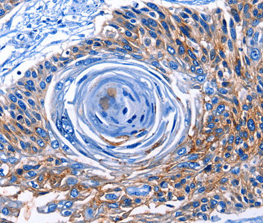 CLEC2B Polyclonal Antibody (E-AB-10243)