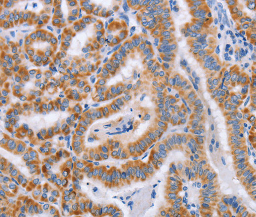 BST1 Polyclonal Antibody (E-AB-13098)