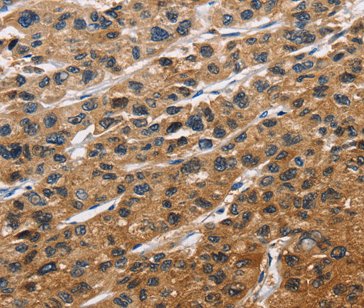 EIF4EBP2 Polyclonal Antibody (E-AB-14802)