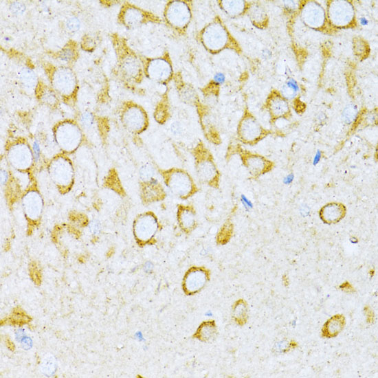 VARS Polyclonal Antibody (E-AB-63778)