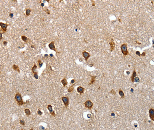 LAMA1 Polyclonal Antibody (E-AB-15755)