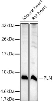 PLN Polyclonal Antibody (E-AB-93218)