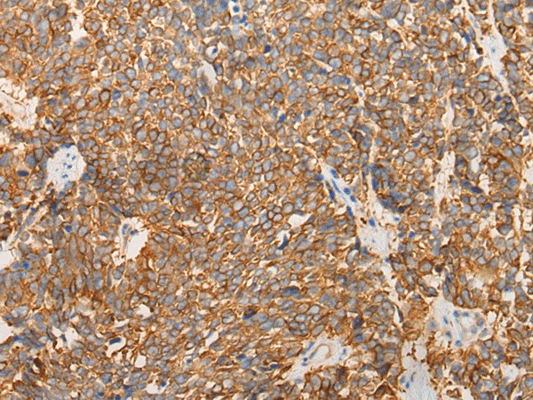 LRRC16A Polyclonal Antibody (E-AB-17767)