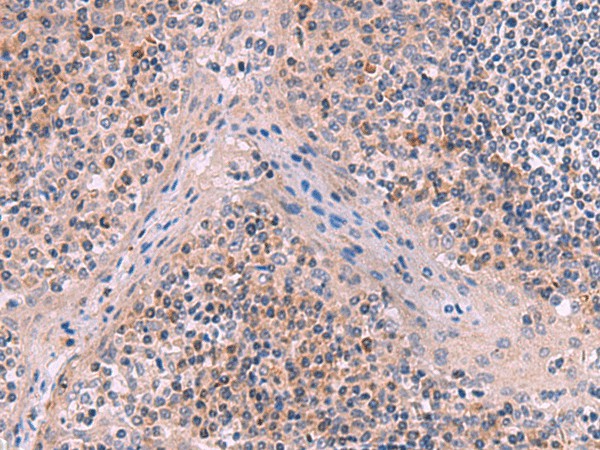 ITIH4 Polyclonal Antibody (E-AB-18138)
