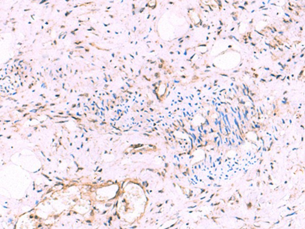 KATNAL1 Polyclonal Antibody (E-AB-19060)