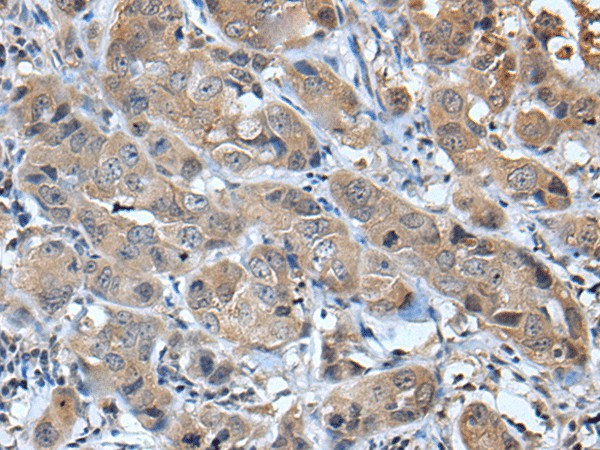 CXCL5 Polyclonal Antibody (E-AB-19497)