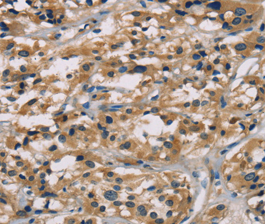 hCG Polyclonal Antibody (E-AB-11076)