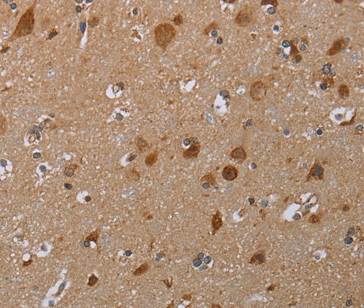 MARK1 Polyclonal Antibody (E-AB-16592)