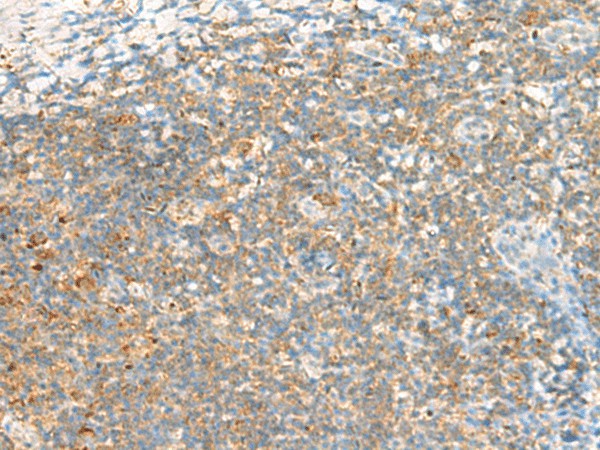 TTLL1 Polyclonal Antibody (E-AB-18832)
