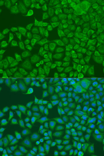 FXR2 Polyclonal Antibody (E-AB-62310)