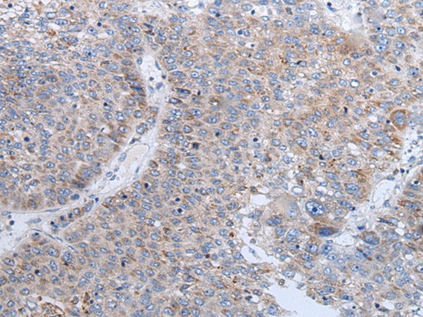 ENPP2 Polyclonal Antibody (E-AB-19626)