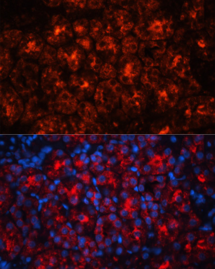 LCN2 Polyclonal Antibody (E-AB-60861)