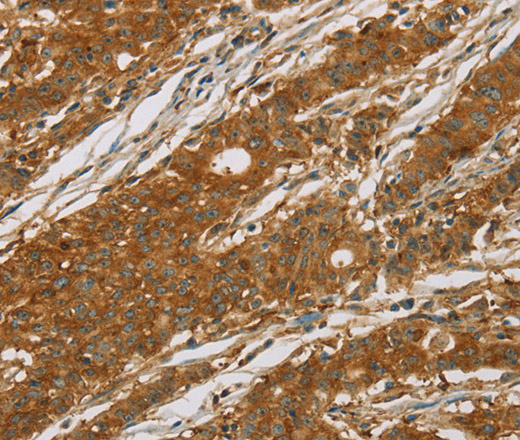 CYP27A1 Polyclonal Antibody (E-AB-11121)