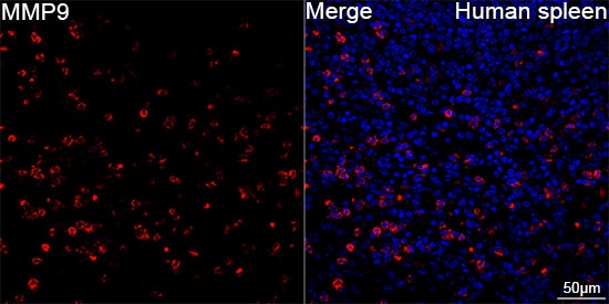 MMP9 Polyclonal Antibody (E-AB-93037)