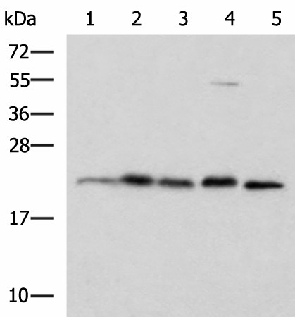 HPCAL1 Polyclonal Antibody (E-AB-53071)