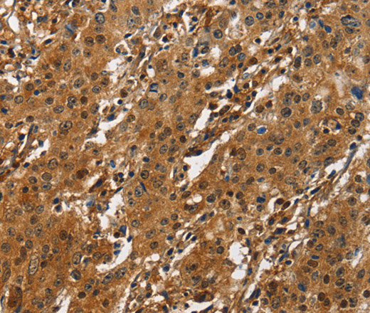 CREB2 Polyclonal Antibody (E-AB-13942)