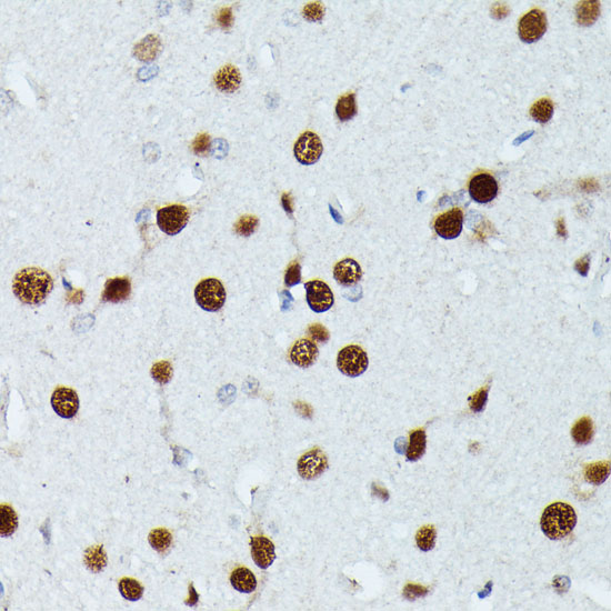 MEF2C Polyclonal Antibody (E-AB-60752)