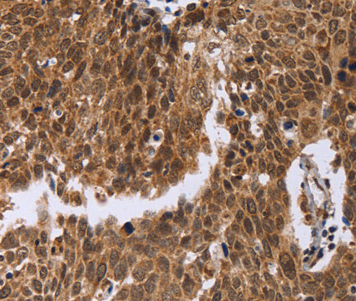 ERCC6L Polyclonal Antibody (E-AB-11196)