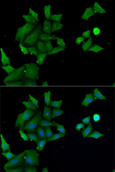 HABP2 Polyclonal Antibody (E-AB-61404)