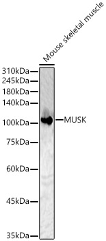 MUSK Polyclonal Antibody (E-AB-92476)