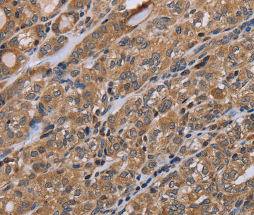 NAA25 Polyclonal Antibody (E-AB-13439)