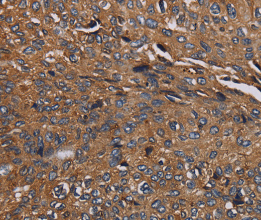 HYAL2 Polyclonal Antibody (E-AB-15116)