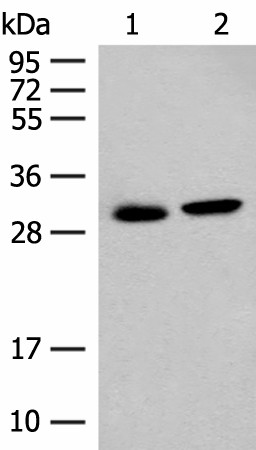 GLYAT Polyclonal Antibody (E-AB-52698)