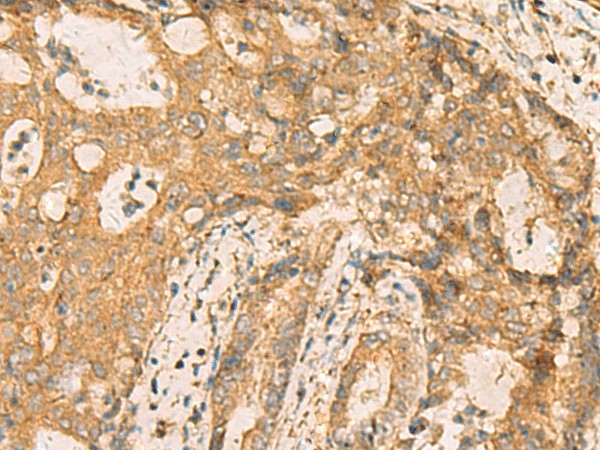 CNST Polyclonal Antibody (E-AB-19205)