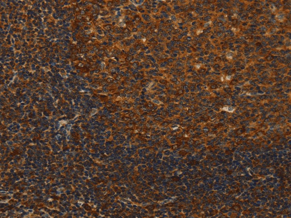 MIP Polyclonal Antibody (E-AB-17308)