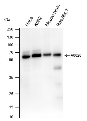 Recombinant ELP3 Monoclonal Antibody (AN301573L)