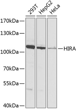 (KO Validated) HIRA Polyclonal Antibody (E-AB-62250)