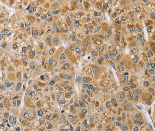 MIP Polyclonal Antibody (E-AB-14597)