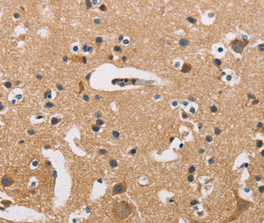 ATP2C1 Polyclonal Antibody (E-AB-10988)