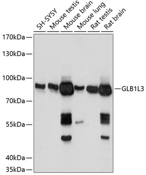GLB1L3 Polyclonal Antibody (E-AB-65161)