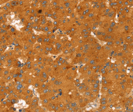 RGS4 Polyclonal Antibody (E-AB-15342)