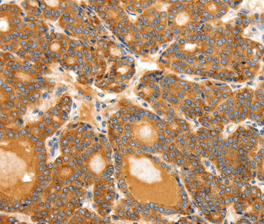 SCT Polyclonal Antibody (E-AB-12865)