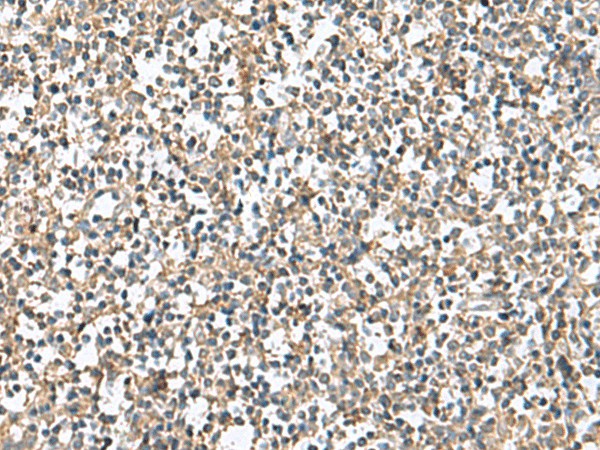 PTPRS Polyclonal Antibody (E-AB-53029)