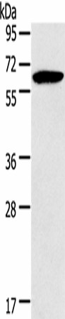 HMGCS2 Polyclonal Antibody (E-AB-16483)