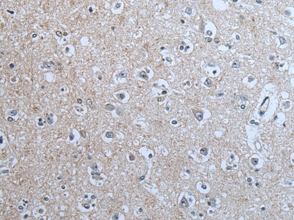 BRSK2 Polyclonal Antibody (E-AB-53606)