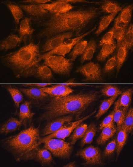 ATP5D Polyclonal Antibody (E-AB-65643)