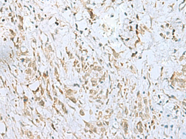 ECT2 Polyclonal Antibody (E-AB-53424)