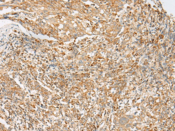 MBOAT4 Polyclonal Antibody (E-AB-17999)