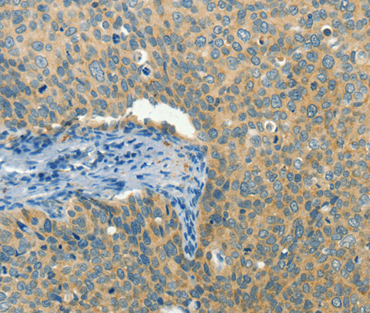 BCAT1 Polyclonal Antibody (E-AB-10995)