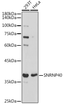 SNRNP40 Polyclonal Antibody (E-AB-92134)