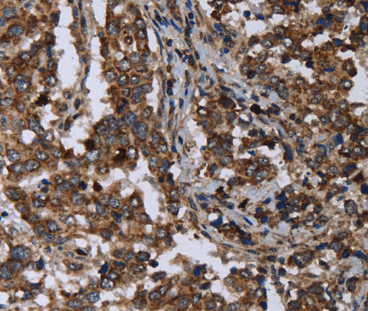 DNAJC15 Polyclonal Antibody (E-AB-15068)