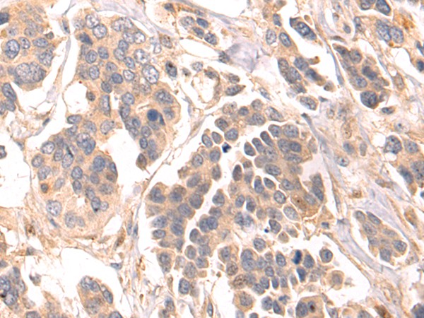 LRRC15 Polyclonal Antibody (E-AB-15178)