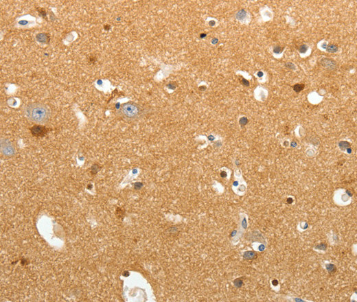 TNR Polyclonal Antibody (E-AB-12898)