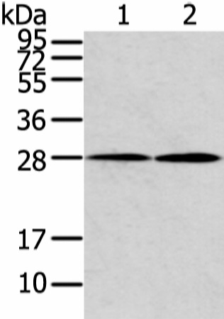 KCNMB1 Polyclonal Antibody (E-AB-17405)